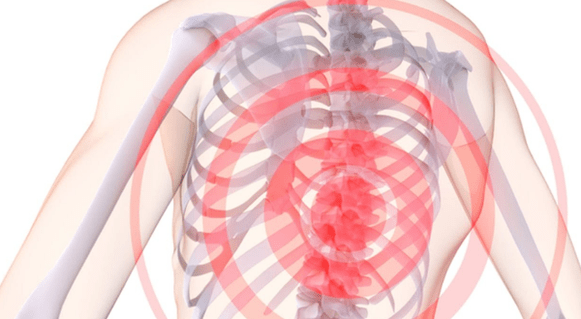 valu lülisambas koos rindkere osteokondroosiga